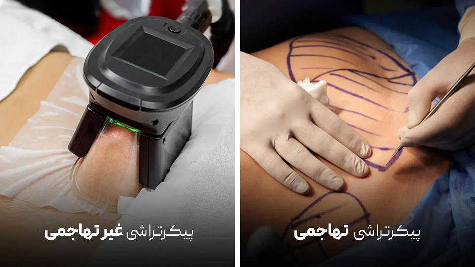 پیکرتراشی کل بدن: روشهای تهاجمی و غیرتهاجمی