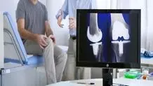 اهمیت شیوه عمل تعویض مفصل زانو و نقش کلیدی پزشک در موفقیت جراحی