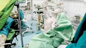 «سقوط» زایمان