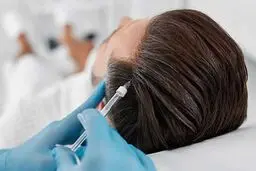 کاشت مو بهتر است یا مزوتراپی؟