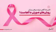روبان‌های صورتی ما کجاست؟ 