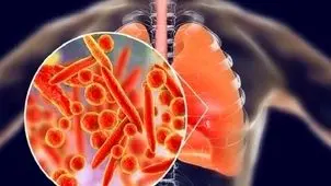 هشدار درباره بیماری انسدادی مزمن ریه