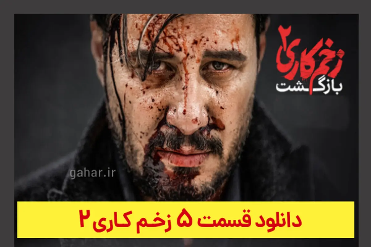 دانلود قسمت ۵ زخم کاری ۲ (دانلود قسمت 5 فصل 2 سریال زخم کاری) ترافیک رایگان