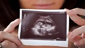 از  نور  اتاق جراحی تا  سایه  زیرزمین