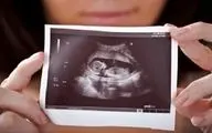 سرنوشت غربالگری جنین در دست وزارت بهداشت است؟
