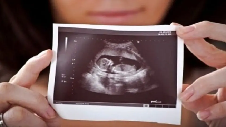 سرنوشت غربالگری جنین در دست وزارت بهداشت است؟
