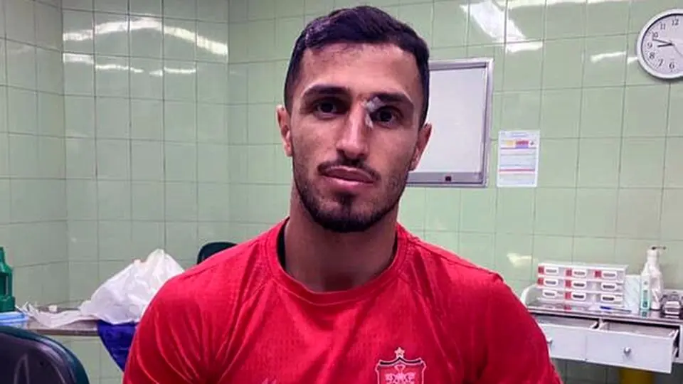 وضعیت علیپور برای دربی مشخص شد