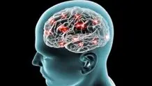 موثرترین راهکارها برای کاهش استرس بیماران مبتلا به آلزایمر در شرایط جنگی