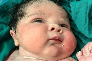 تولد نوزاد دختر ۶ کیلوگرمی در سنندج+ عکس