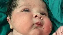 تولد نوزاد دختر ۶ کیلوگرمی در سنندج+ عکس