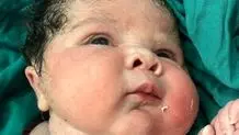 تولد نوزاد دختر ۶ کیلوگرمی در سنندج+ عکس