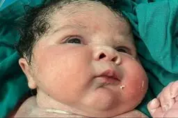 تولد نوزاد دختر ۶ کیلوگرمی در سنندج+ عکس