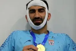 فک بیرانوند شکست