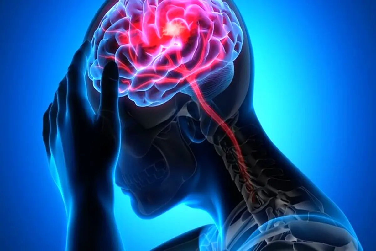 پژوهش جدید: این شرایط می‌تواند مغز انسان را کوچک‌تر کند