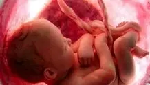 گام موثر علوم پزشکی در مسیر بین‌المللی‌سازی سلامت و جذب سرمایه‌گذاری خارجی