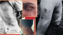 پشت‌پرده حمله به گردشگران در «اوپرت» با سلاح گرم و شوکر چه بود؟

