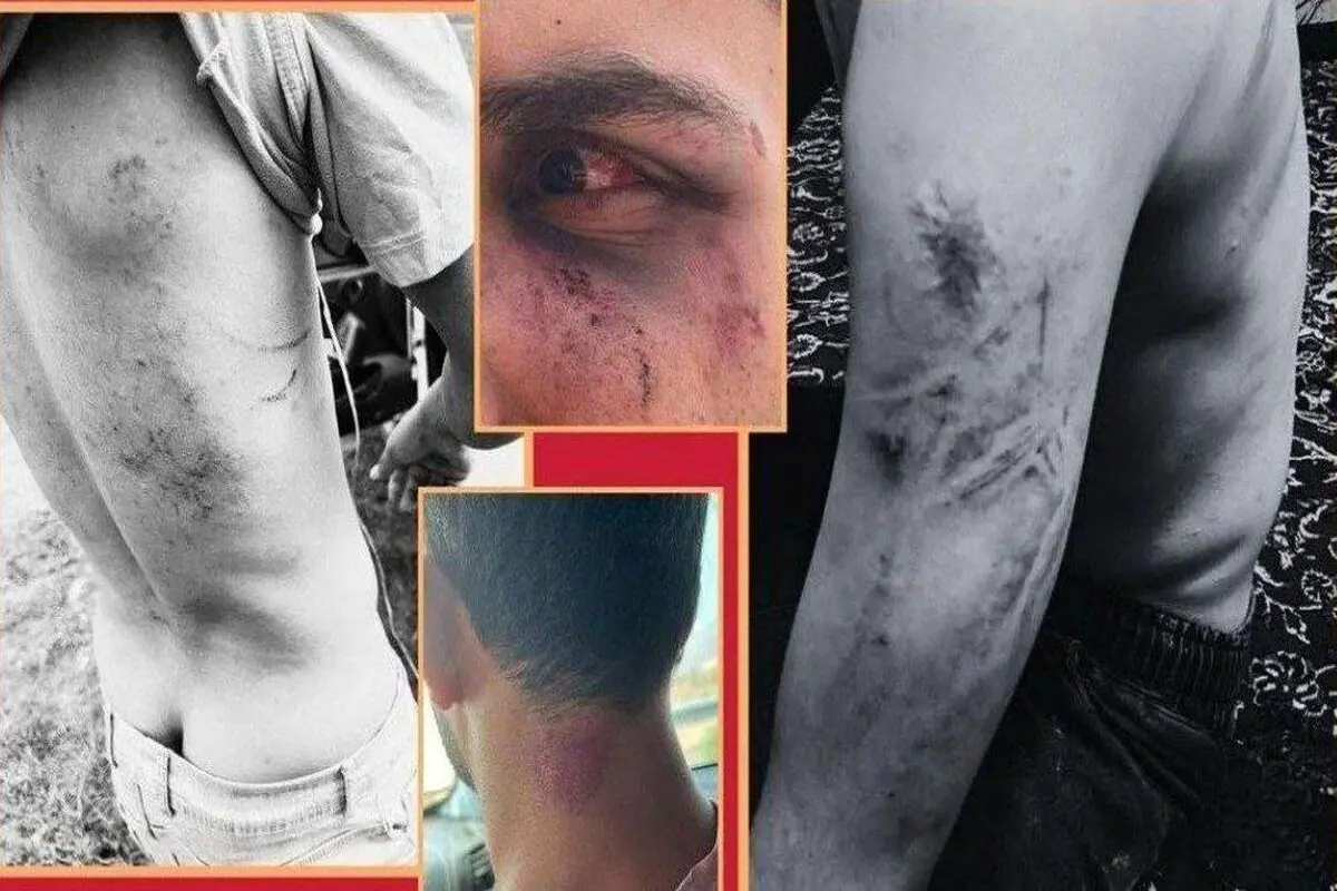 پشت‌پرده حمله به گردشگران در «اوپرت» با سلاح گرم و شوکر چه بود؟

