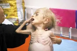 بار تحمل‌ناپذیر دیدن