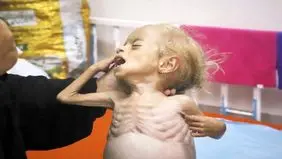 بار تحمل‌ناپذیر دیدن