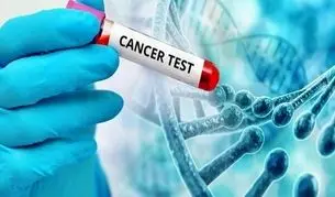 غربالگری؛ یک راهبرد اقتصادی در مدیریت سرطان