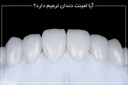 آیا لمینت دندان ترمیم دارد؟