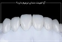 آیا لمینت دندان ترمیم دارد؟
