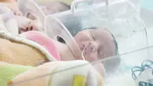 افزایش تولد نوزادان با اختلالات کروموزومی