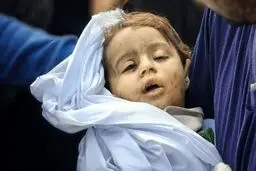 ۱۳۵۰ کودک و نوجوان ایرانی  مصدوم شده است