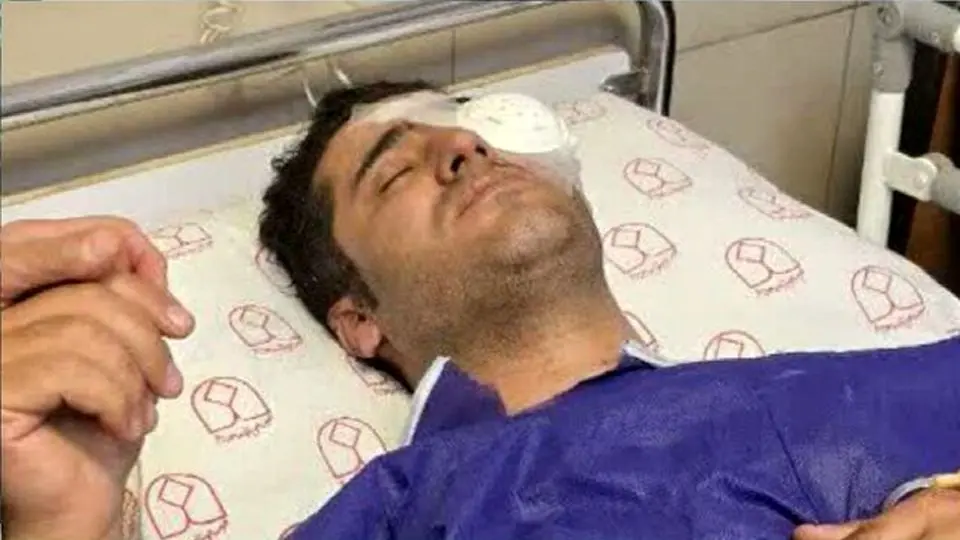 شلیک وحشتناک شکارچیان متخلف به یک محیط‌بان در اصفهان/ پیگیری محیط زیست برای درمان محیط‌بان 