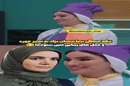 عمل‌های زیبایی متین ستوده سوژه نیما شعبان‌نژاد شد + فیلم