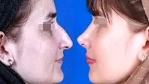 پزشکان عمومی، دست به «چاقو»