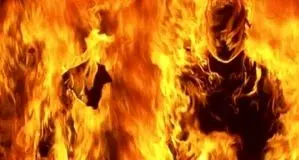 وضعیت وخیم «احمد» در بیمارستان سوختگی اهواز