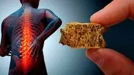 قاتل بی‌صدا در کمین زنان؛ بیشتر از مردان در خطرند