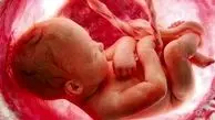وزارت بهداشت خبر تولد ۱۲ نوزاد با سندروم داون را تکذیب کرد

