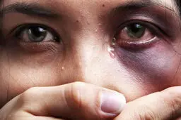 خشونت خانگی؛ باید سکوت زنان شکسته شود
