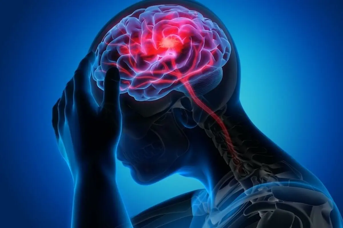 سن ابتلا به آلزایمر به ۴۹‌سالگی رسید