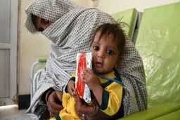 ۳.۵ میلیون کودک زیر پنج سال در افغانستان به سوءتغذیه مبتلا هستند 