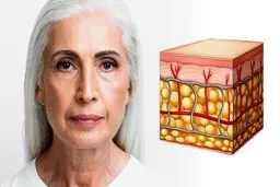 چه چیزی کلاژن را برای پوست ضروری می کند؟