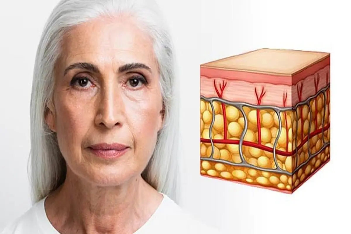 چه چیزی کلاژن را برای پوست ضروری می کند؟