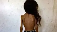 آغاز مرحله دوم حمله رژیم تل آویو به غزه