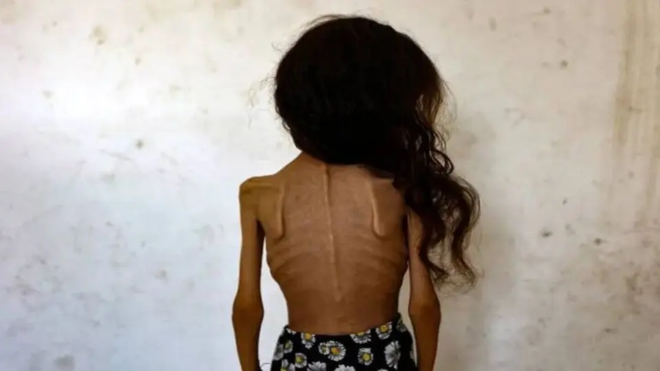 «بدون شرح»؛ کاریکاتور تلخ نشریه ایتالیایی در واکنش به گرسنگان غزه+ عکس