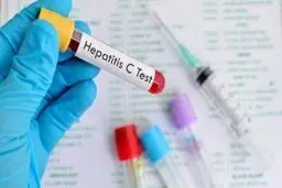 وزارت بهداشت: آغاز طرح کنترل هپاتیت B از سال آینده