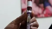 انقلاب در واکسیناسیون؛ واکسن بدون سوزن با نخ دندان!


