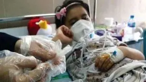 شمار بیماران تنفسی گیلان دو برابر شد