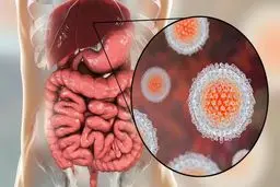 ۱۷۰ هزار نفر مبتلا به هپاتیت سی هستند 