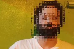 انتشار تصاویر تلخ بریدن گوش دختر نوجوان در فضای مجازی/ دادستان مازندران: با فرد متخلف برخورد جدی می شود