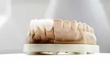 آیا ونیر کامپوزیت دندان باعث حساسیت دندان می‌شود؟