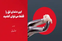 این دندان لق را فقط می‌توان کشید