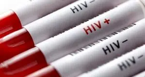 افشای اطلاعات محرمانه بیماران HIV