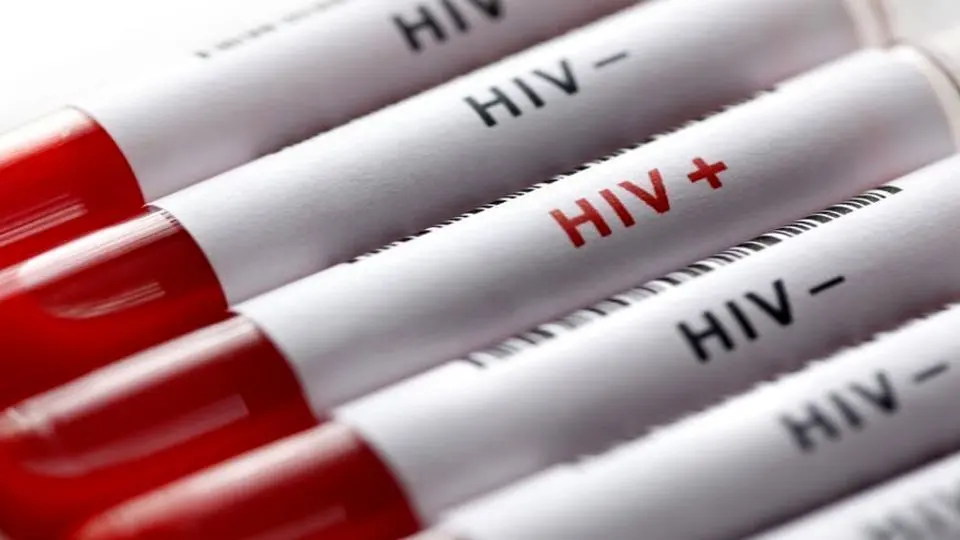 افشای اطلاعات محرمانه بیماران HIV